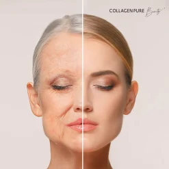 Mediakos GmbH Collagen Pure Beauty - Hochdosiert Mit 10g Kollagen (28x25 Ml) Set -Essen Verkäufe 14234f0a13835f0174a28523aff5361f